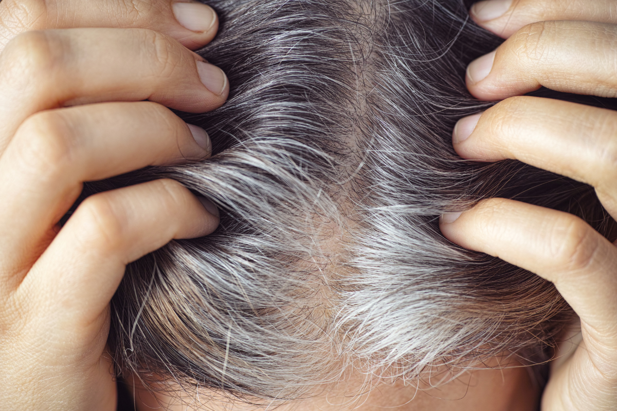 A person showing gray and white hairs.